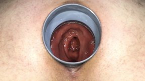 Extreme mastdarm insertions & fisting – hardcore anal gaping & elbow deep dildo action